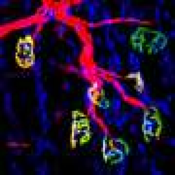  Restoring nerve-muscle connections boosts strength of aging mice, study finds