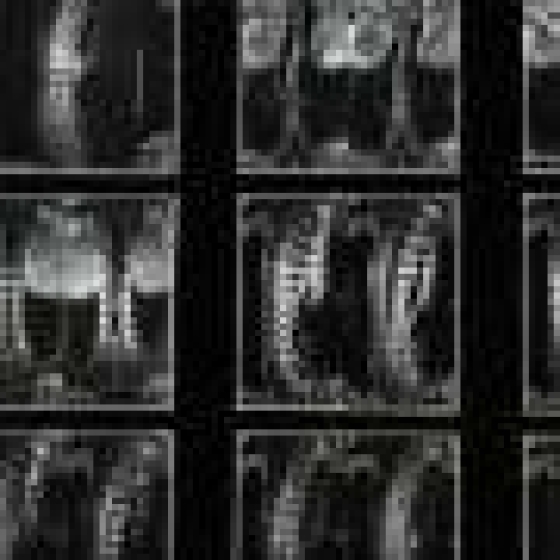  Arm fat may reveal women and men at risk of spinal fracture