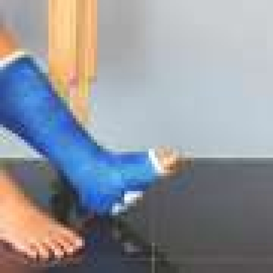  Fracture risk higher in women with type 2 diabetes due to poorer physical function