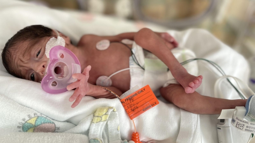 Want to Lower Preterm Birth Rates? Spend More on Social Programs