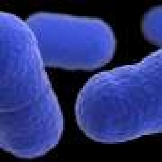  Listeria outbreak tied to Yu Shang Food leaves California infant dead and 10 people sick