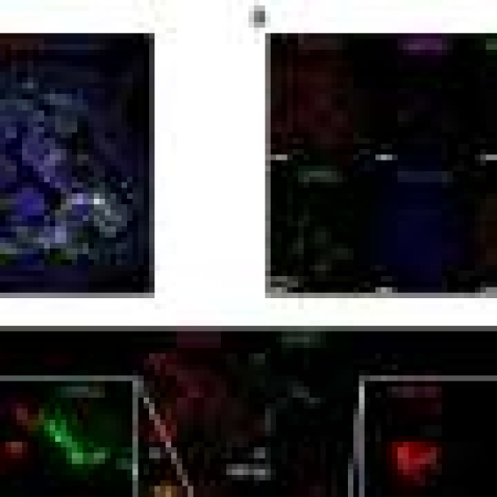  UTIs are extraordinarily common but kidney infections are not—now doctors know why