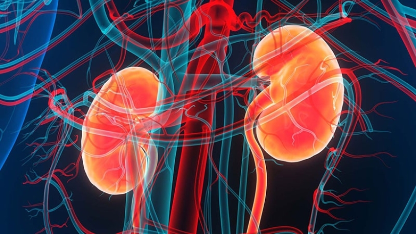  Obinutuzumab a Success in Phase 3 Trial for Lupus Nephritis