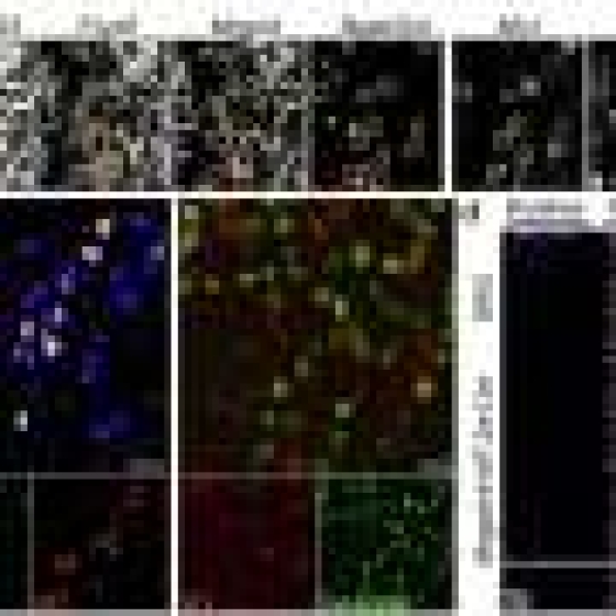 How inflammation alters nerve cell responses to make touch painful