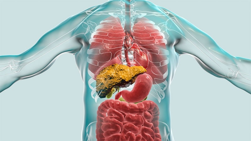 Preemptive TIPS Promising for Fundal Variceal Bleeding