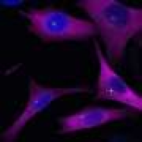 Melanoma ‘cellular compass’ discovery could help curb metastasis