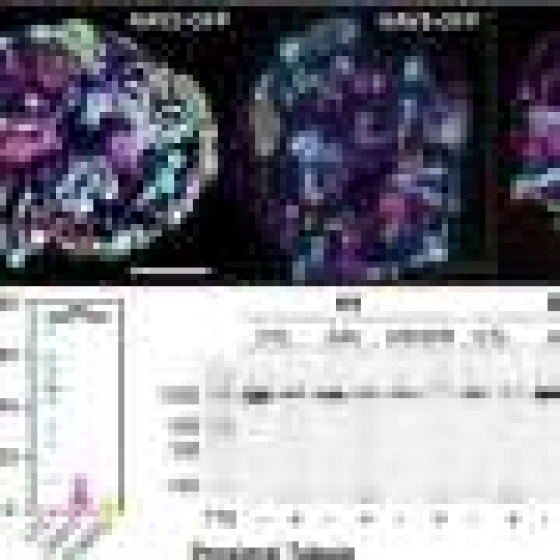 Q&A: How organoids could make gene therapy trials safer by identifying hidden risks early on