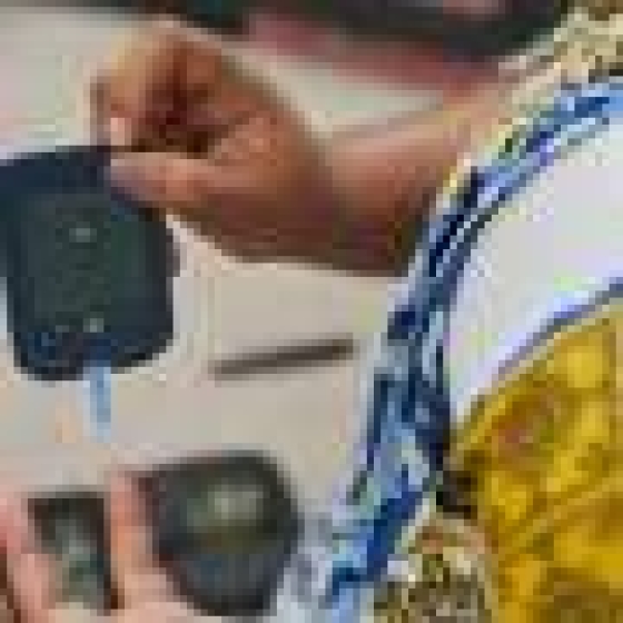  People with learning disabilities seem to progress faster to severe type 2 diabetes