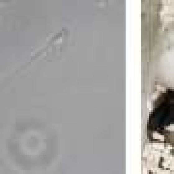 mRNA therapy restores sperm production and fertility in mice