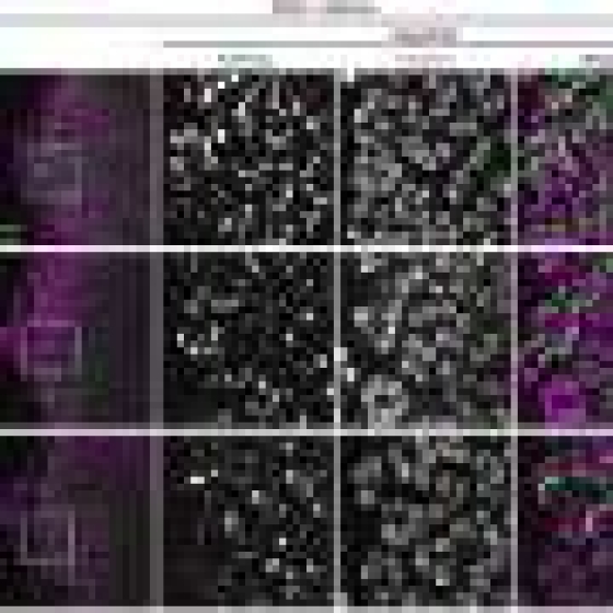 Arginine supplementation curbs Alzheimer’s disease pathology in animal models