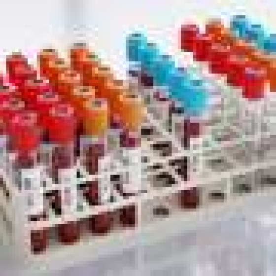 Poor kidney health linked to higher levels of Alzheimer’s biomarkers in blood